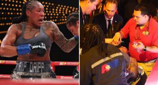 Shadasia Green Dirawat di ICU Setelah Mengalami Pendarahan Otak